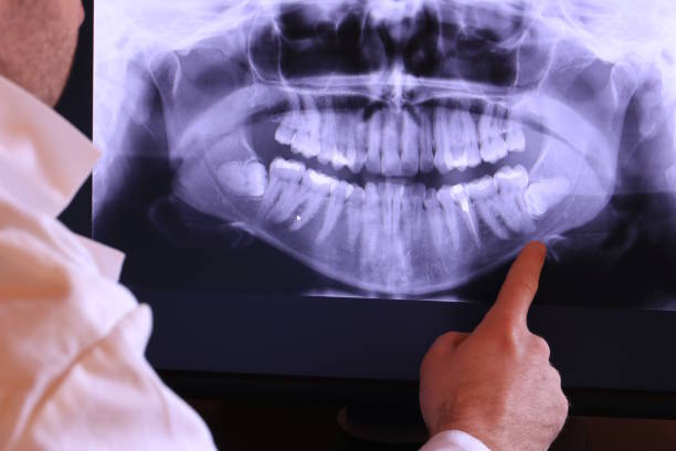 Best Emergency Gum Treatment in Prestonsburg, KY